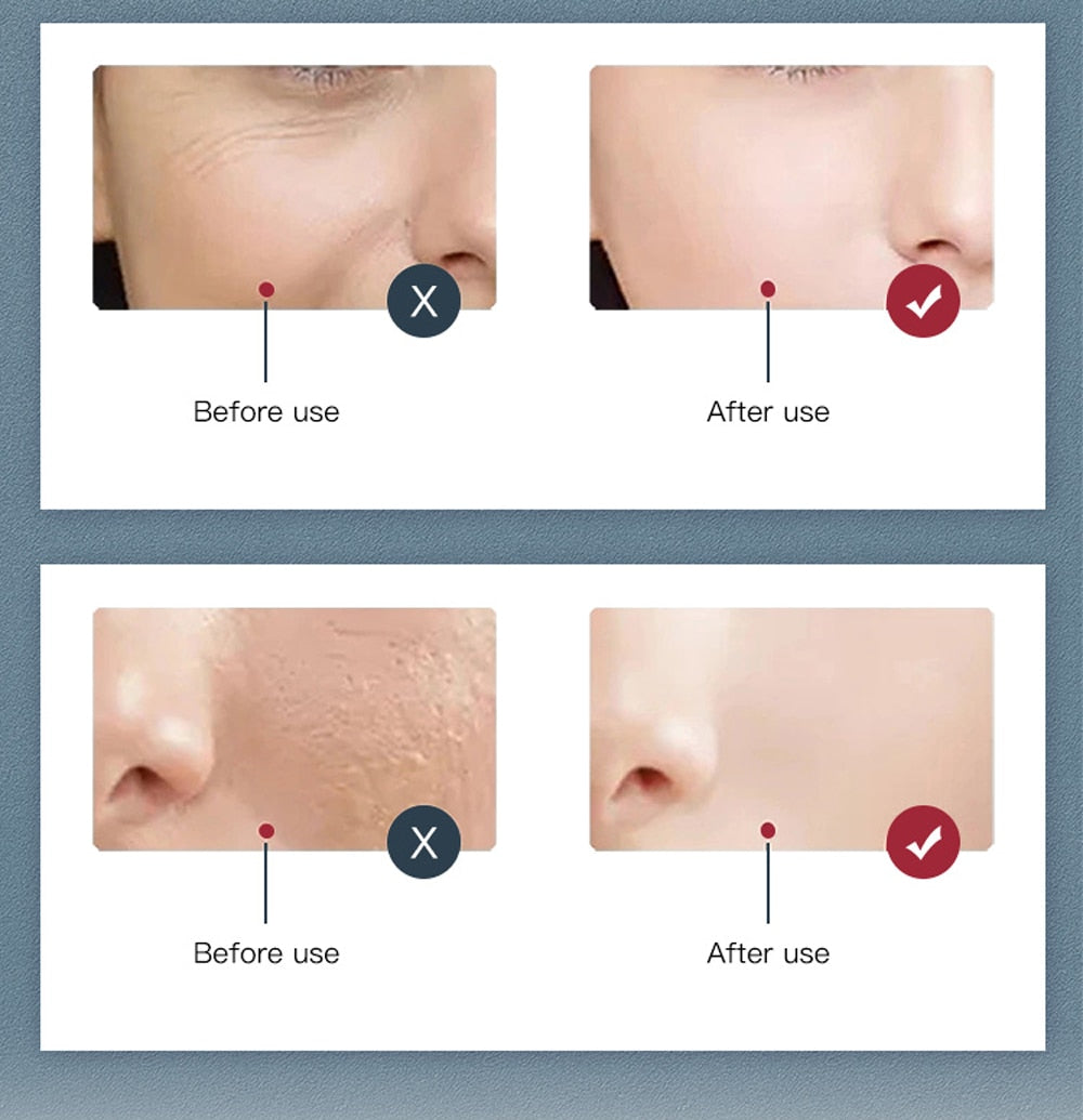7 Colors LED Facial Mask Therapy